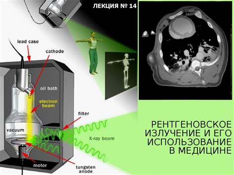 Прохождение рентгеновского излучения через ткани и его взаимодействие с различными материалами