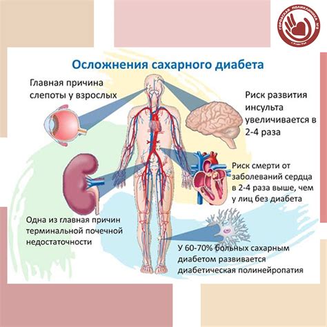 Психологический аспект управления состоянием здоровья при диагнозе сахарный диабет: преодоление трудностей для облегчения повседневной жизни