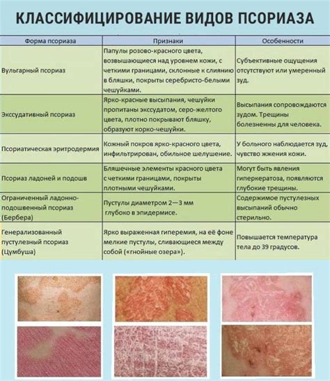 Псориаз и другие дерматологические заболевания