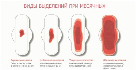 Разнообразные интерпретации снов, содержащих изображение месячных выделений