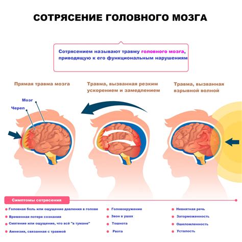 Распознавание симптомов сотрясения головного мозга и их важность