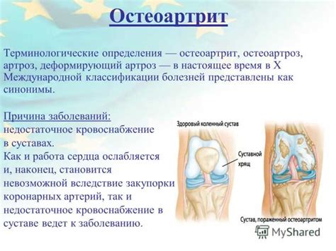 Распространенные дегенеративные заболевания суставов