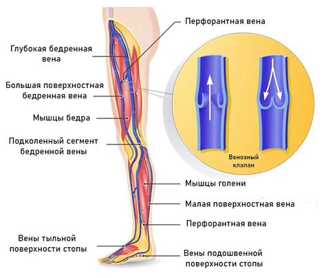 Расширение вен в нижних конечностях: причины и профилактика