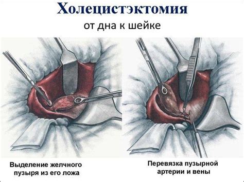 Реабилитационный период после хирургического вмешательства на миндалины: советы и особенности