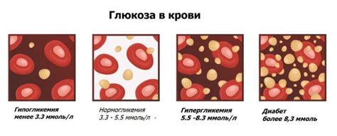 Рекомендации по снижению уровня глюкозы в организме