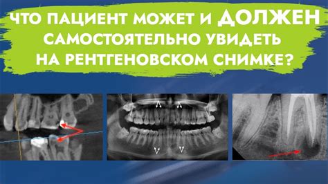 Рентгеновское исследование: фундаментальные принципы и широкий спектр применения