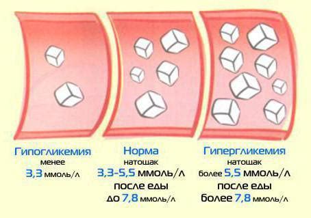 Риск заболевания диабетом при употреблении сладких продуктов перед сном