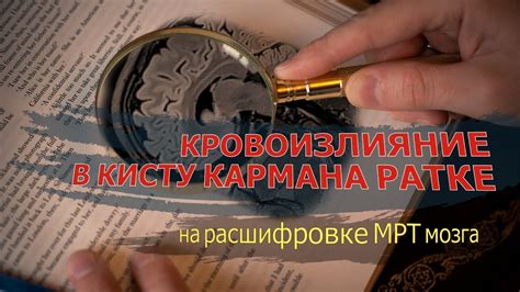 Роль быстрой реакции при подозрении на внутреннее кровоизлияние головы