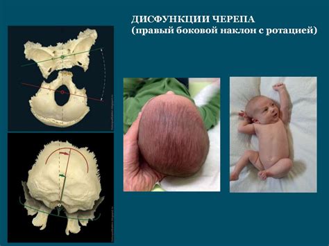 Роль остеопатического лечения в поддержании здоровья детского организма