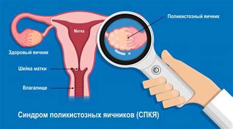 Роль питания в поддержании нормального уровня гормона ФСГ у женщин