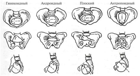 Роль применения различных методов исследования в выявлении клинического сужения таза при родах