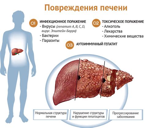 Связь повышенного уровня альфа-липопротеина с нарушениями функции печени