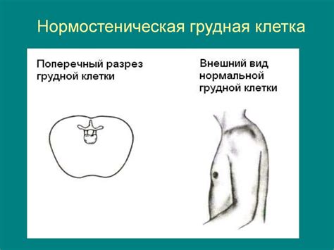 Сжатие и дискомфорт в области грудной клетки