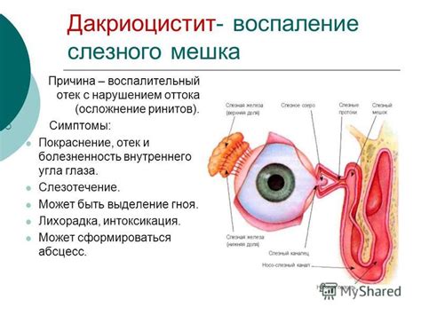 Симптомы: болезненность и отек