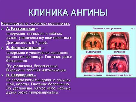 Симптомы и признаки наличия образований на поверхности миндалин