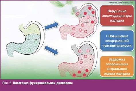 Симптомы несварения желудка