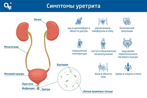 Симптомы неспецифического уретрита у мужчин