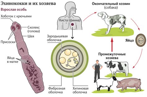 Симптомы поражения эхинококком и их проявление у человека