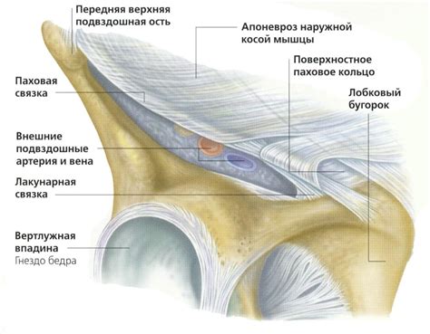 Симптомы разрыва паховой связки и их распознавание