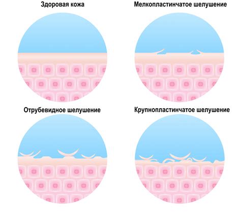 Следите за изменениями на поверхности кожи