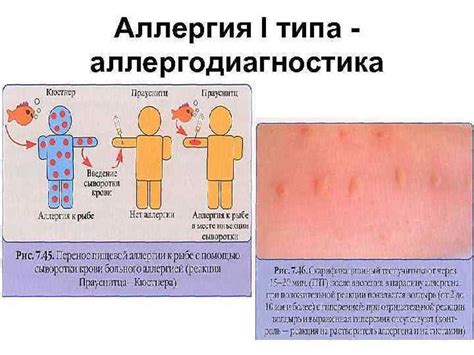 Снижение вероятности возникновения аллергических реакций у детей возрастом от 1 до 4 лет