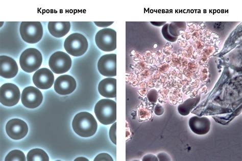 Способы снижения содержания вещества, способствующего образованию мочевой кислоты в бобовых