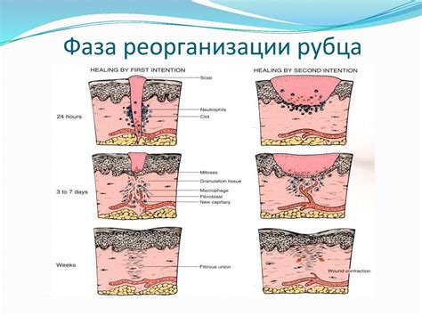 Способы ускорения процесса заживления ран и рубцов