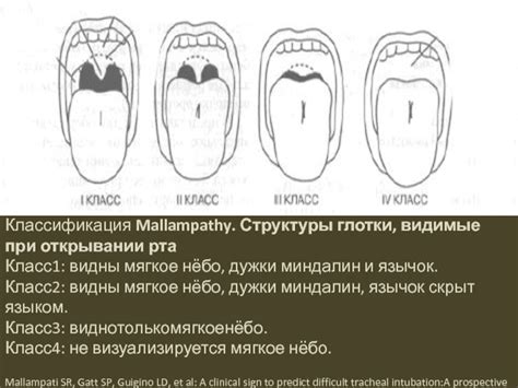 Структуры, формирующие периферию глотки