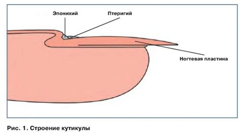 Сухость кутикулы и заусенцы: возможные факторы и способы предотвращения