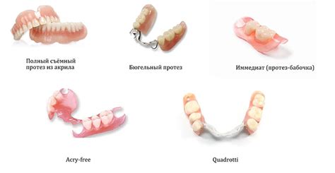 Съемные протезы - альтернатива имплантации