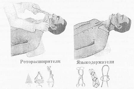 Техники выполнения искусственного дыхания в различных ситуациях