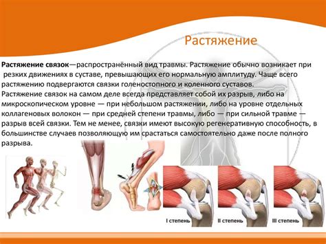 Типичные признаки ослабления связок и возможные причины