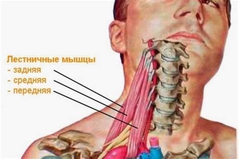 Травмы и перенапряжение шейных мышц