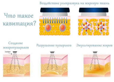 Ультразвуковая уз процедура: превосходства и особенности метода