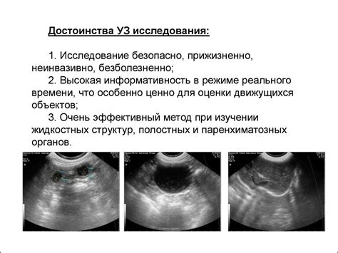 Ультразвуковые исследования как эффективный метод определения пола горбуша