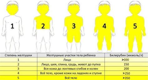 Физиологические факторы, влияющие на низкий уровень общего билирубина у младенца