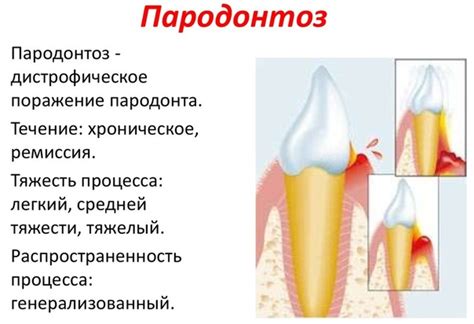 Физиотерапевтические методы улучшения состояния десен