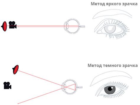 Фотоакустическая технология: эволюция взгляда через суперлазеры