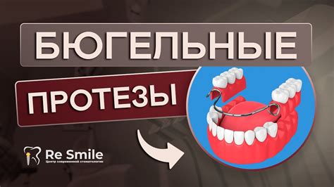 Частичные протезы: удобное решение для восстановления отсутствующих зубов