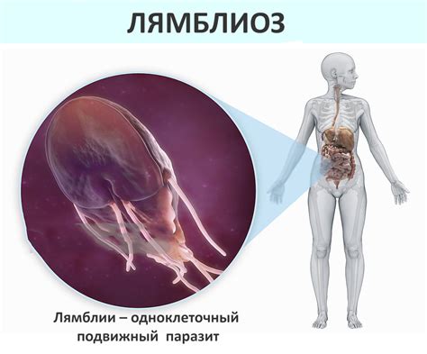 Что такое заболевание лямблиоз и причины его возникновения