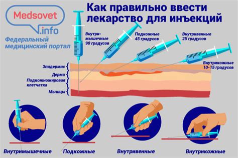 Шаги для безопасной внутривенной инъекции