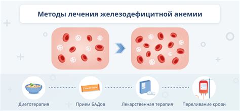 Эффективные методы лечения и контроля синдрома Железодефицитной Анемии