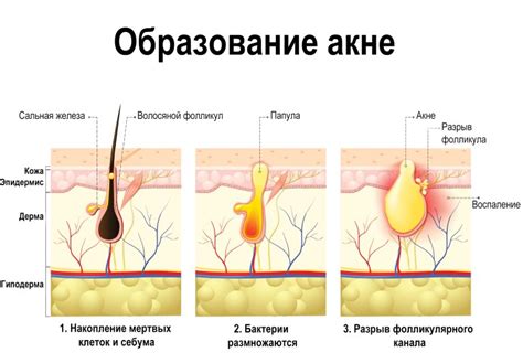  Значение VAC в CS:GO и его роль в поддержании адекватной игровой среды 