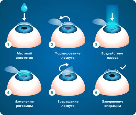  Необходимые документы для получения специального разрешения на хирургическую процедуру по коррекции зрения для пожилых жителей Тулы 