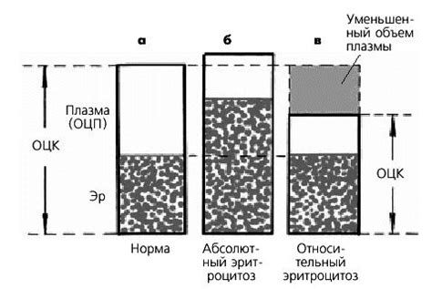  Определение гематокрита при микроцитозе 