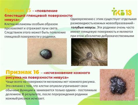  Факторы, которые могут усугубить ситуацию с выступающими образованиями на коже после процедуры нанесения татуировки 