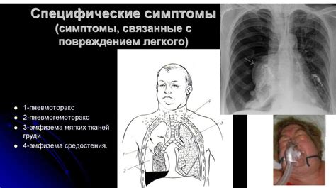  Флюорография: ранняя диагностика патологий дыхательной системы 